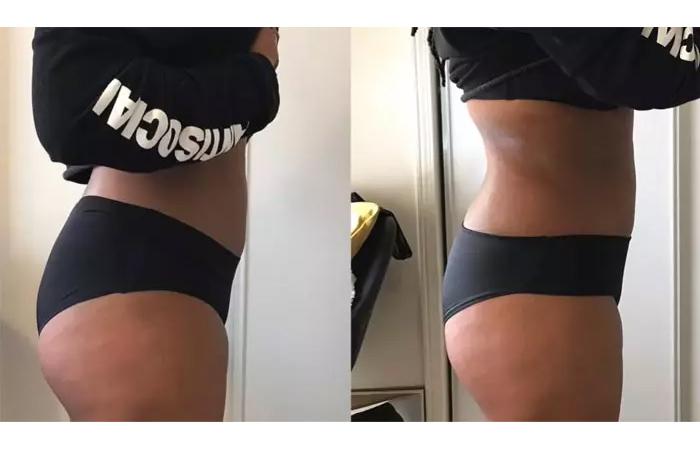 Best At-Home Body Contouring Machine Review + Before and After Results  After 3 Weeks! - Video Summarizer - Glarity