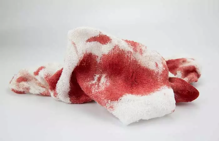 Blood Stains