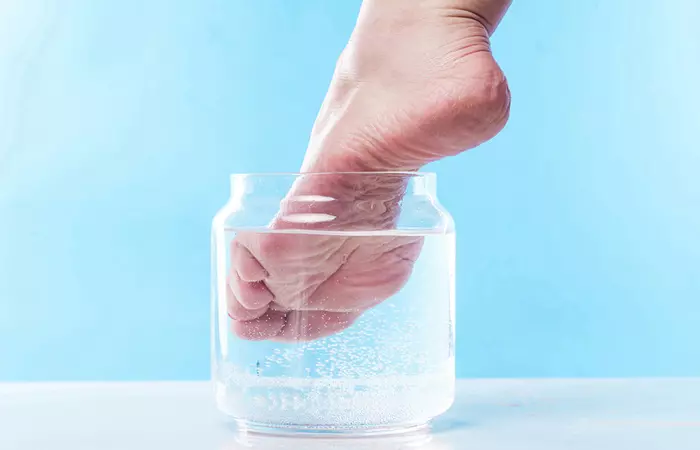 How To Cure Cracked Heels