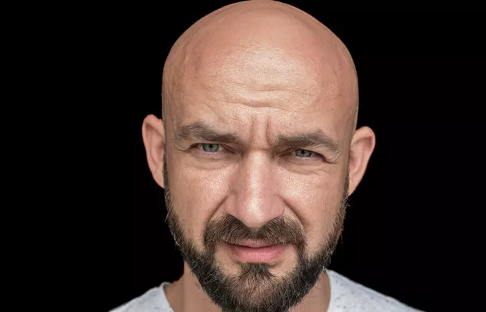 Male Baldness Definitely Is Inherited From The Paternal Side Of The Family