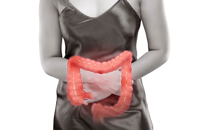What Is Ulcerative Colitis
