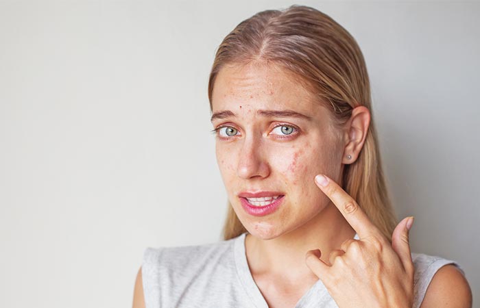 Cosmetic Allergy: Everything You Need To Know - Live Heathly Life