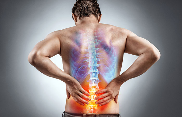 Causes of Back Pain