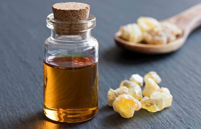 Frankincense oil for lupus