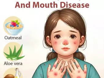 12 Effective Home Remedies For Hand, Foot, And Mouth Disease