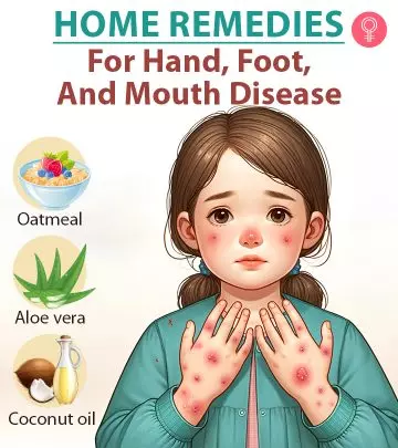 12 Effective Home Remedies For Hand, Foot, And Mouth Disease