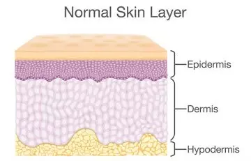 The anatomy normal skin layer