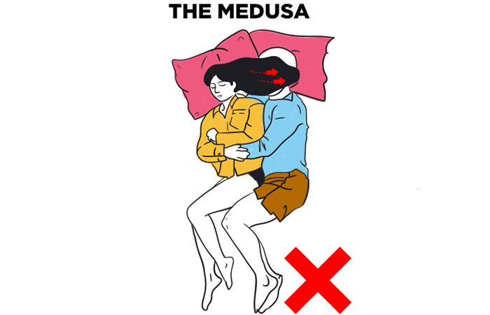  The Medusa