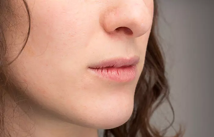 chapped lips chapped lips