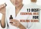 13 Best Essential Oils For Scars To Reduce And Heal Them