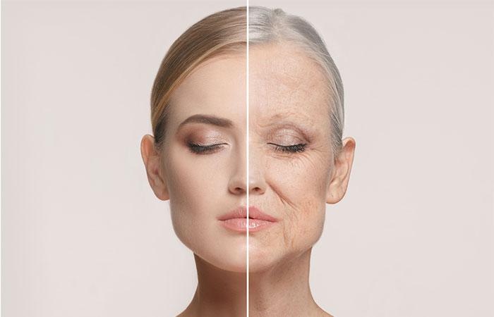 Skin aging