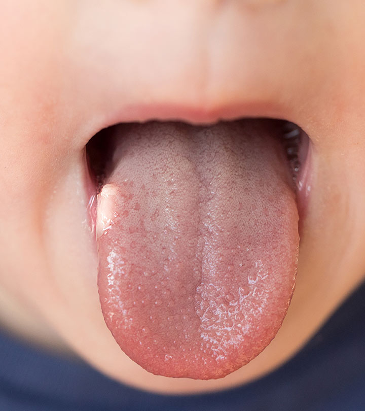 If You Have Bumps On Your Tongue, Here’s What They Could Mean