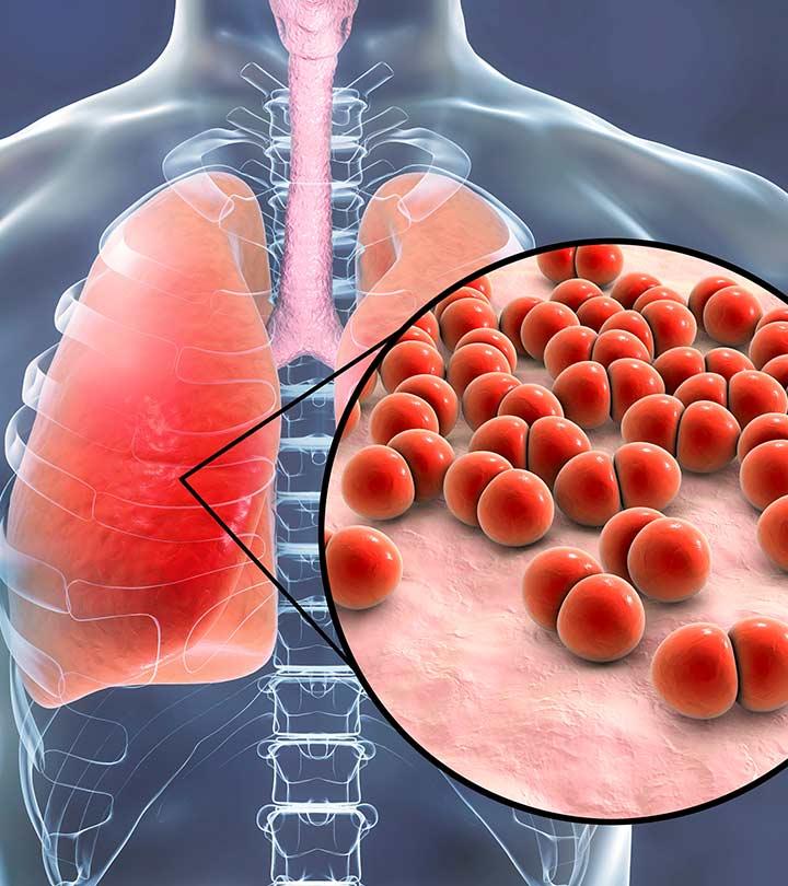 What Is Pneumonia In Hindi Definition