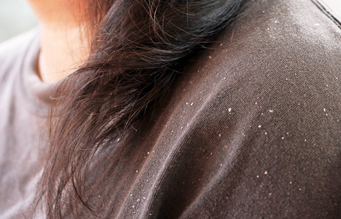 Benefits of glycerin for dandruff