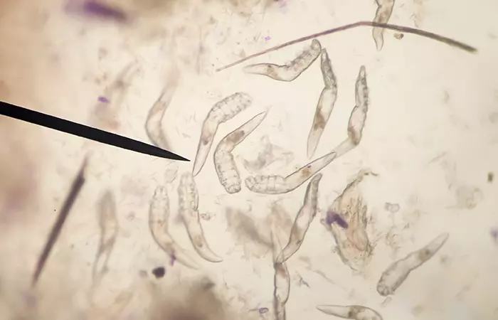 Diagnosing and treating face mites