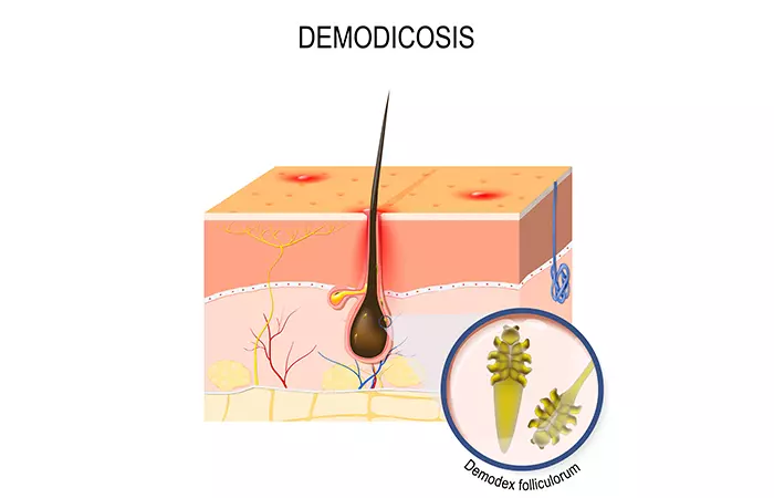 Face mites causes