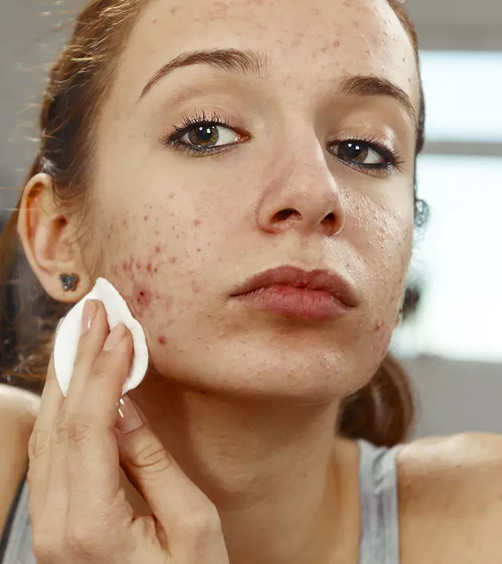 Combining home remedies and medicated creams can solve this issue effectively.