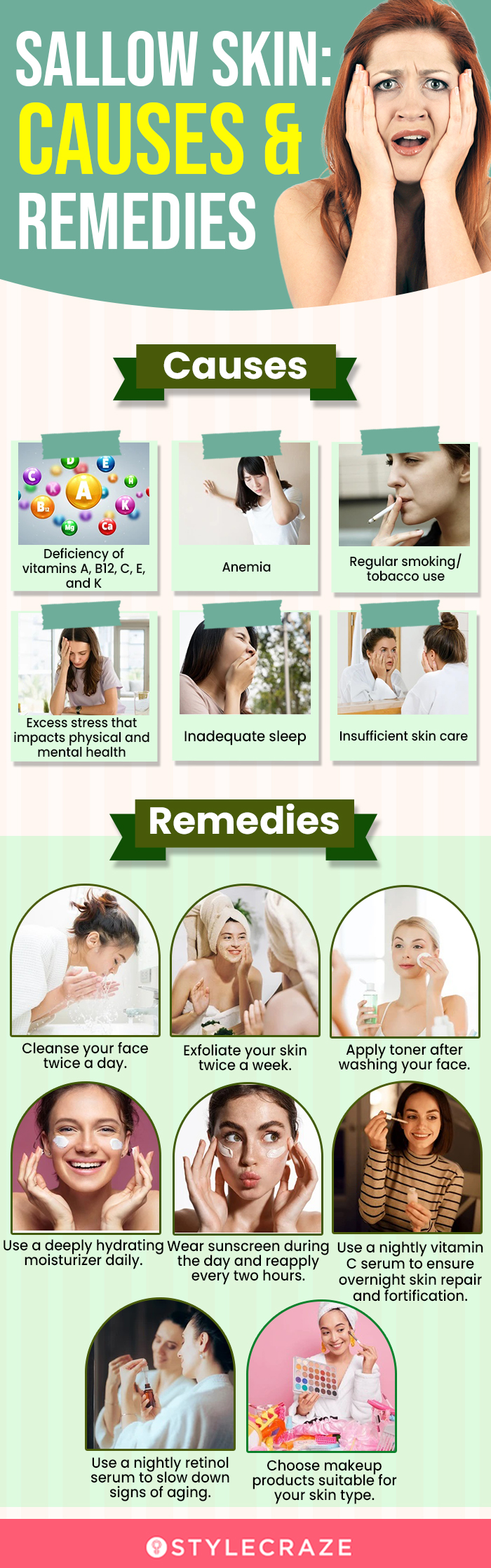 sallow skin causes & remedies (infographic)