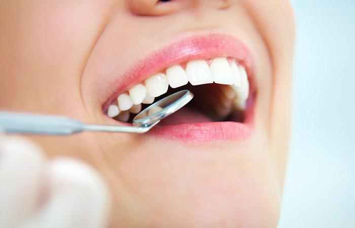  Dental healing and oral