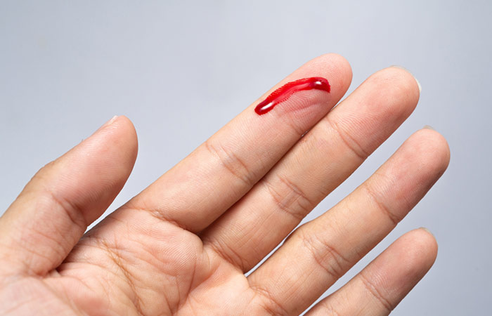 Stop bleeding