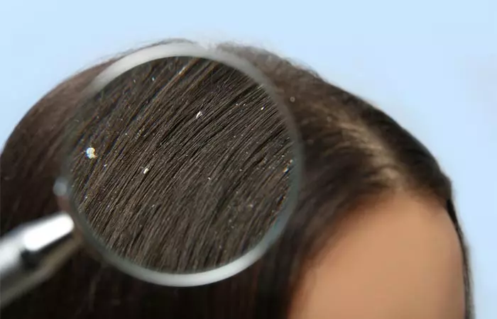 Girl looking at her hair flakes in the mirror 