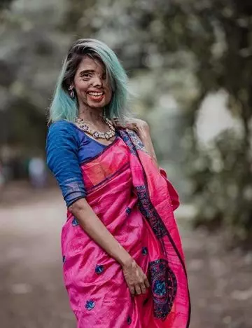 Here’s How This Acid Attack Survivor1