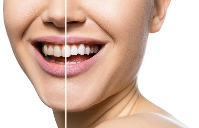 Oral Health