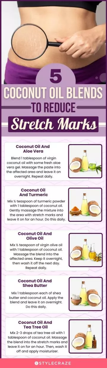 5 coconut oil blends to reduce stretch marks (infographic)