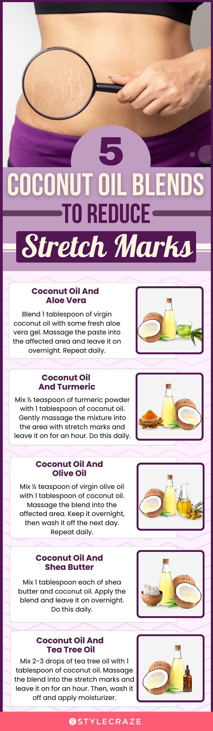 5 coconut oil blends to reduce stretch marks (infographic)