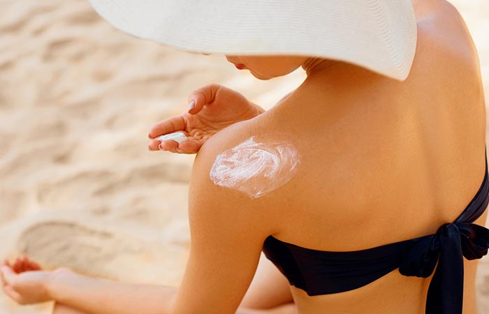 Woman applying sunscreen to reduce the appearance of stretch marks