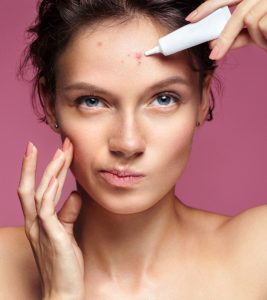 15 Best Acne Spot Treatments For Flaw...