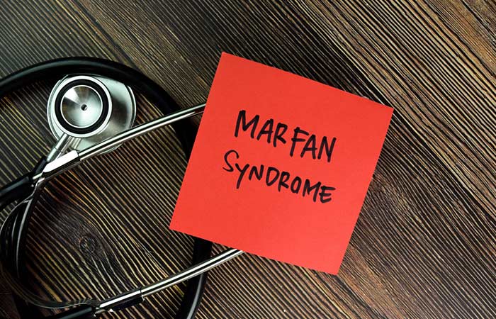A sticky note with Marfan syndrome written on it