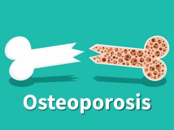 Home Remedies for Osteoporosis in Hindi,