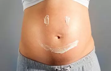 Woman with prescribed topical ointment applied to stretch marks to prevent itchiness