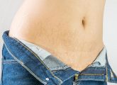 Stretch Marks In Teenagers – How They Develop And How To Treat ...