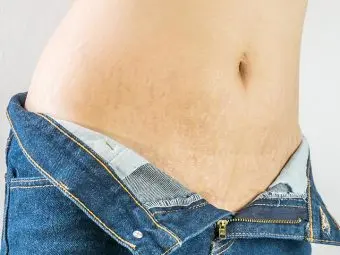 Stretch Marks In Teenagers – How They Develop And How To Treat ...