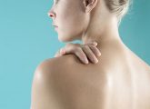 Stretch Marks On The Shoulders: Why You Get Them And How To ...