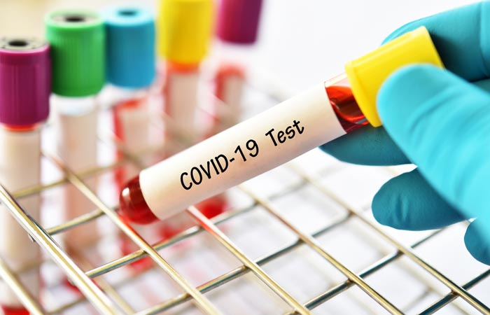 What are the symptoms of Covid-1