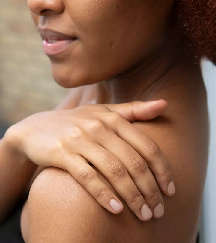 Stretch Marks On The Shoulders: Why You Get Them And How To ...