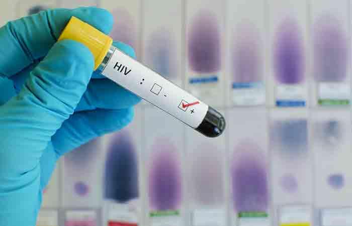 HIVAIDS