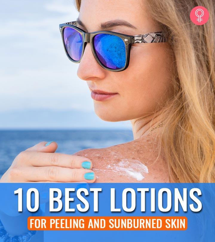 lotion for sunburn peeling