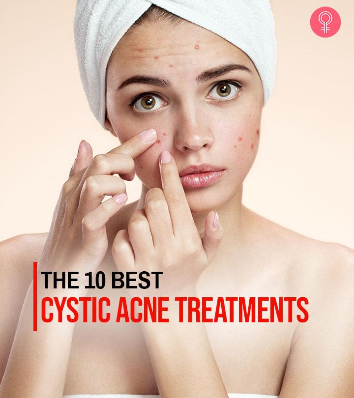 12 Best Cystic Acne Treatments That Work Like A Charm – 2023