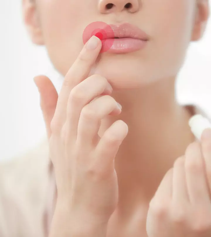 Best Lip Balms To Treat Cold Sores