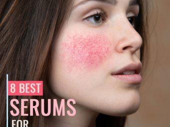 8 Best Serums For Rosacea – 2020