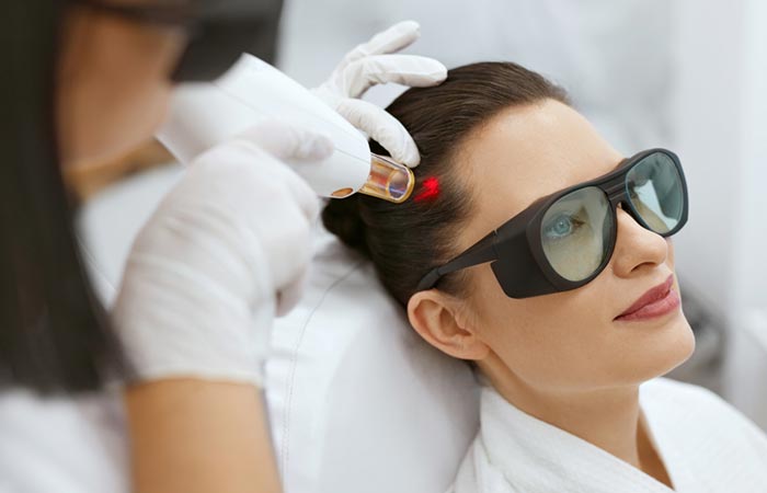 Woman undergoing laser therapy to stop hair fall