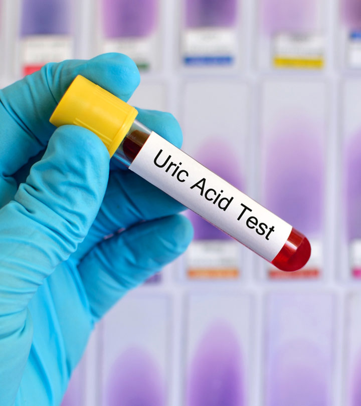 यूरिक एसिड बढ़ने के लक्षण, कारण और घरेलू उपाय : Home Remedies for Uric Acid In Hindi