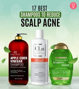 These Are The 13 Best Scalp Acne Sham...