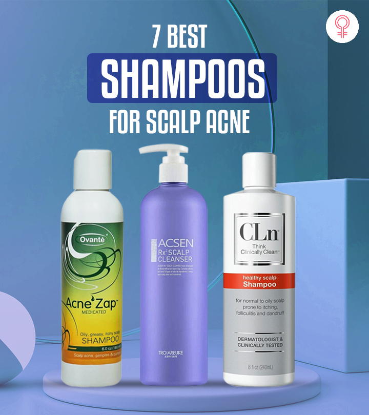 best shampoo for buildup on scalp
