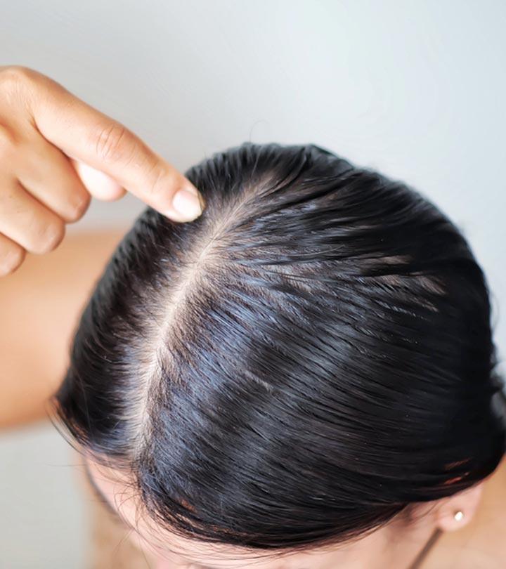 Home Remedies for Oily Hair