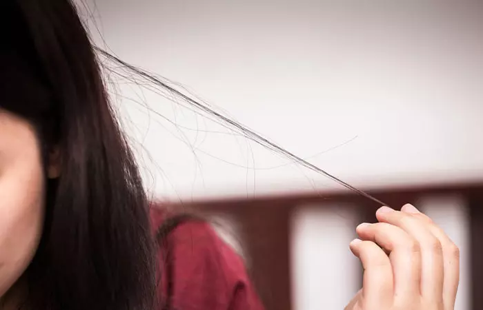 Woman facing Trichotillomania